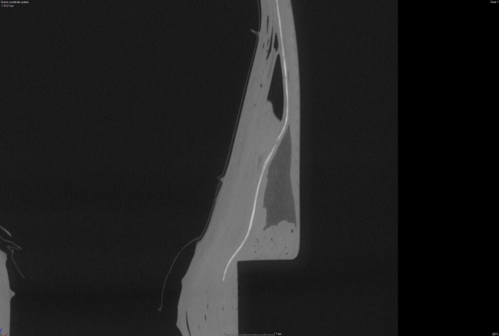 A CT scan showing the layers of carbon in a bike fork